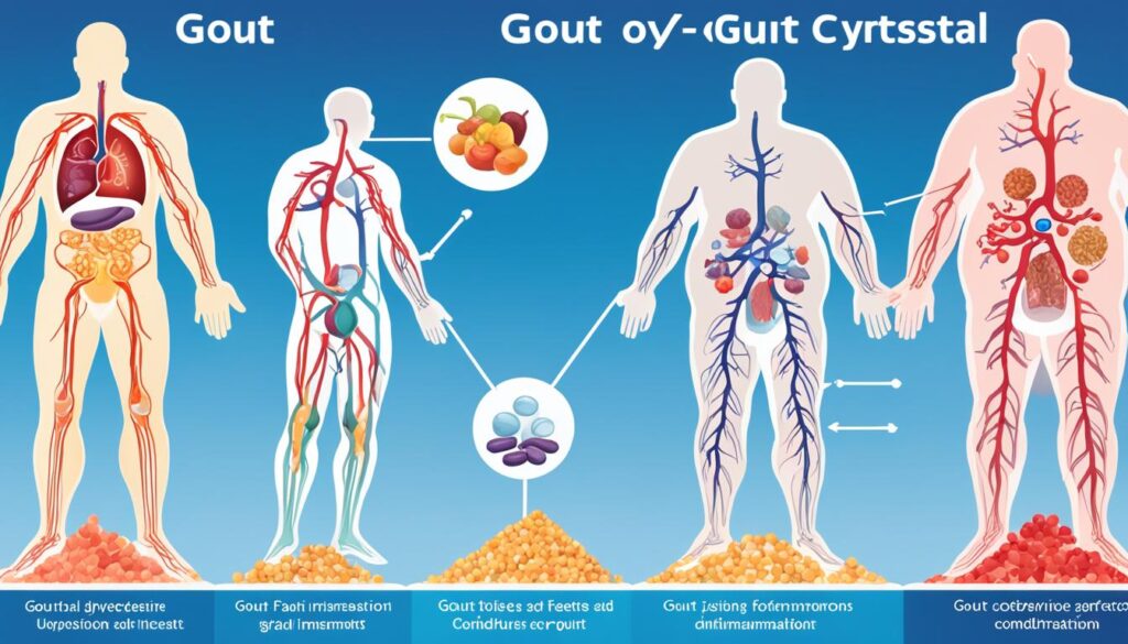 underlying conditions gout